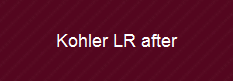 Kohler LR after